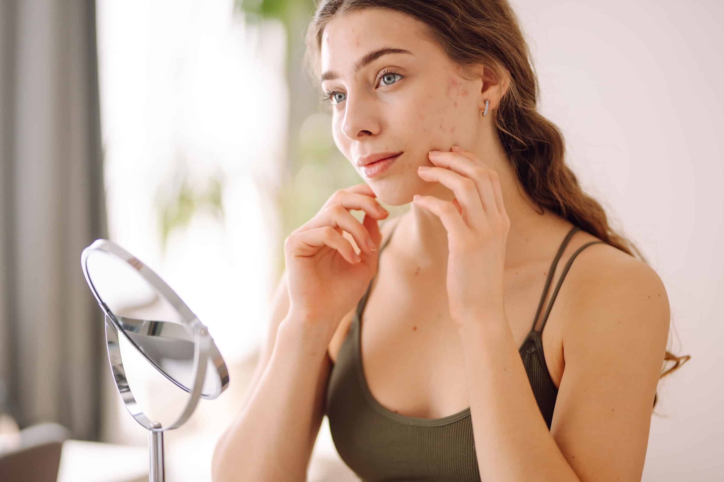 Vaincre l’acné rosacée avec des traitements naturels. Vaincre l'acné rosacée avec des traitements naturels.